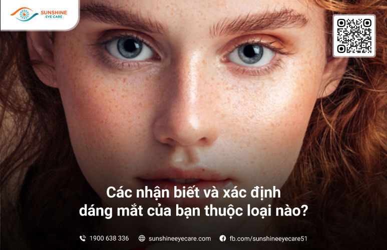 các loại mắt