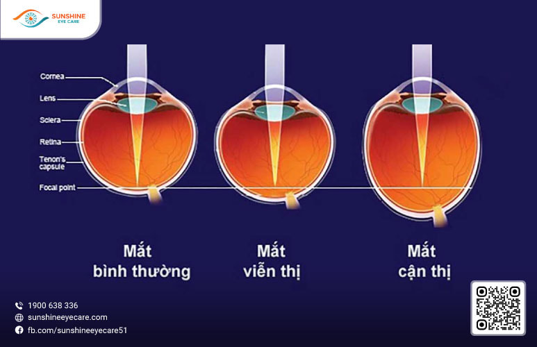 cắt kính giá bao nhiêu