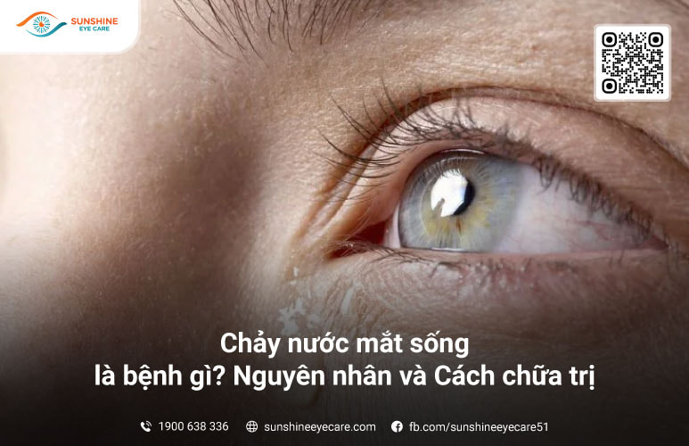 chảy nước mắt sống