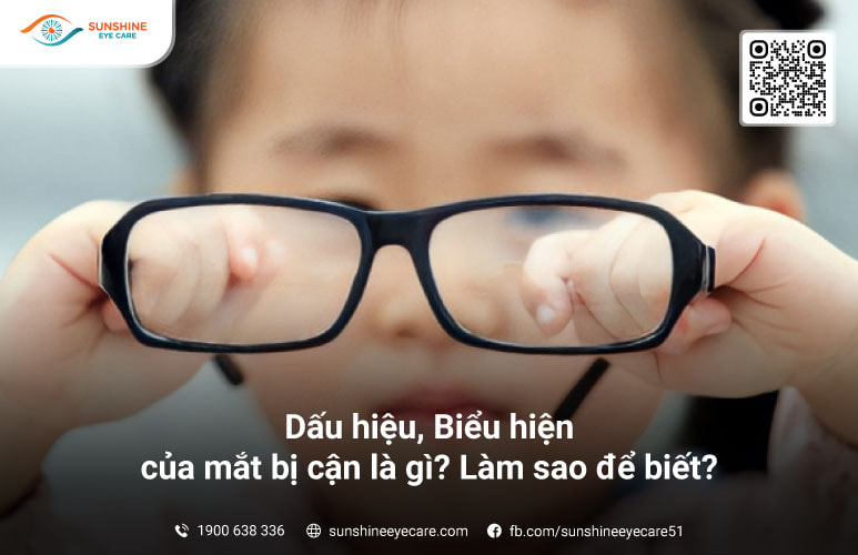 dấu hiệu bị cận