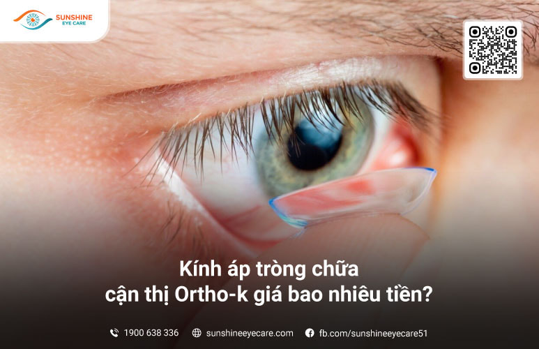 Quy trình thăm khám và sử dụng kính Ortho-K