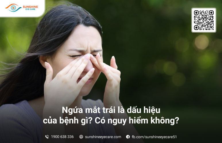 Ngứa Mí Mắt Trái: Nguyên Nhân, Triệu Chứng và Cách Điều Trị Hiệu Quả