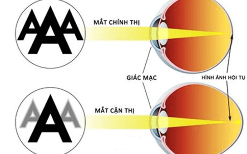 3. Triệu Chứng Và Dấu Hiệu Nhận Biết