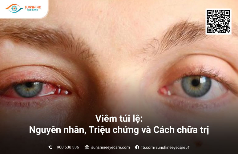 viêm tuyến lệ