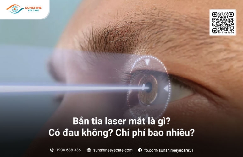 Bắn tia laser mắt là gì? Có đau không? Chi phí bao nhiêu?